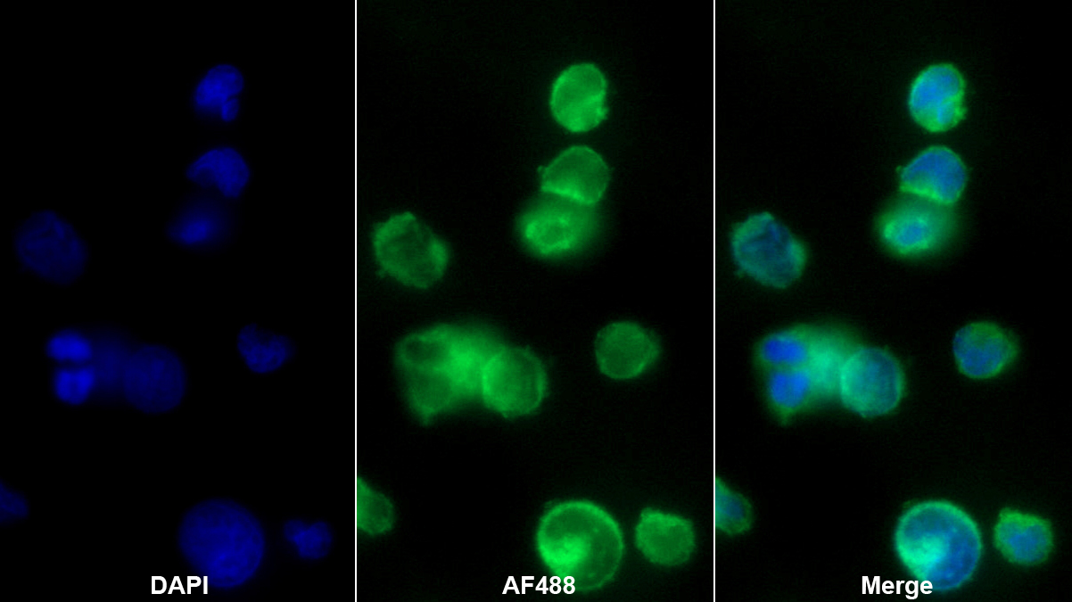 Polyclonal Antibody to Fc Fragment Of IgG Low Affinity IIIa Receptor (FcgR3A)