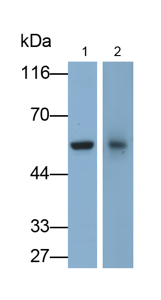 Polyclonal Antibody to Fc Fragment Of IgG Low Affinity IIIa Receptor (FcgR3A)