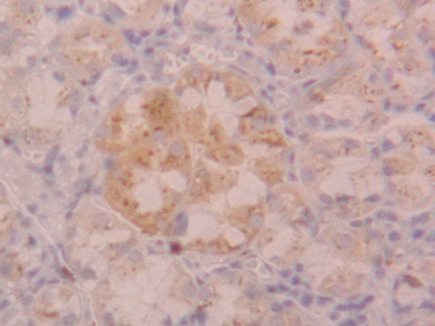 Polyclonal Antibody to Cathepsin D (CTSD)