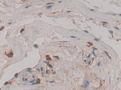 Polyclonal Antibody to Cathepsin D (CTSD)