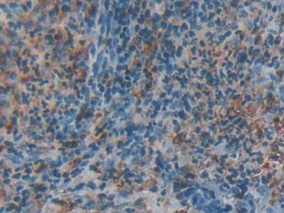 Polyclonal Antibody to Cathepsin D (CTSD)