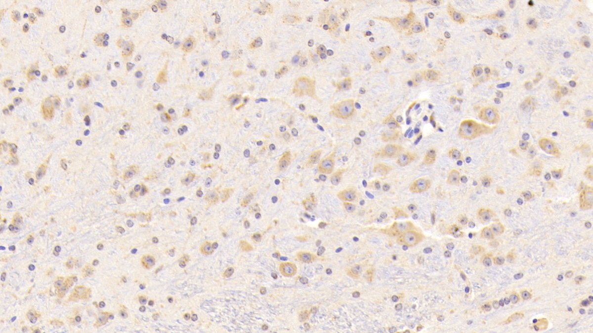 Polyclonal Antibody to Cathepsin D (CTSD)