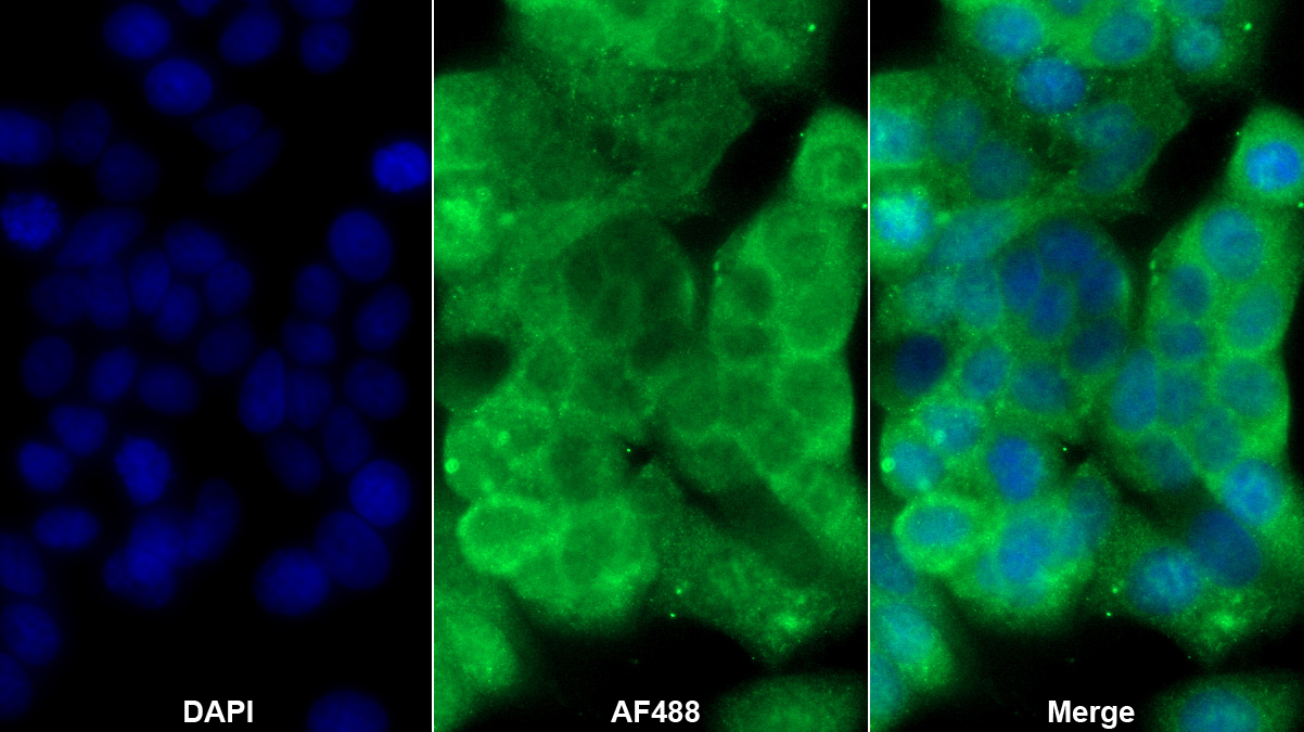 Polyclonal Antibody to Cathepsin D (CTSD)