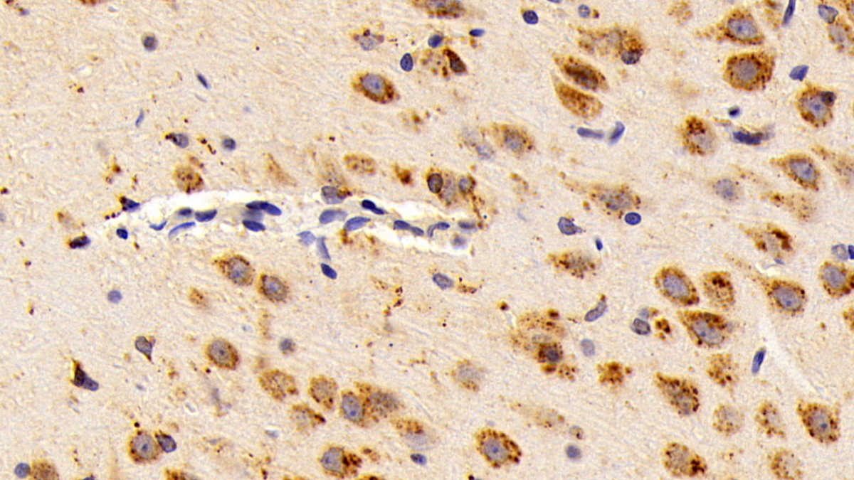 Polyclonal Antibody to Cathepsin D (CTSD)