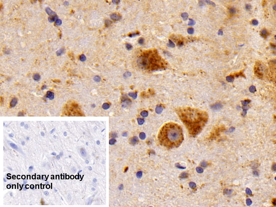 Polyclonal Antibody to Cathepsin D (CTSD)