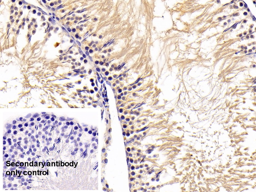 Polyclonal Antibody to Cathepsin D (CTSD)