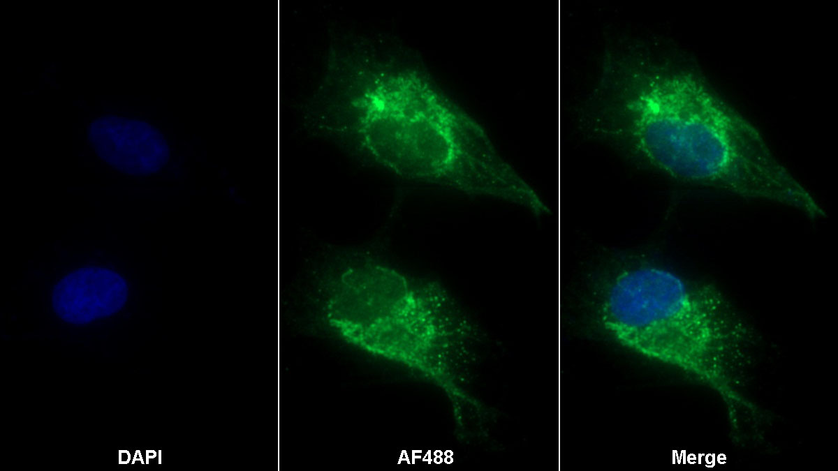 Polyclonal Antibody to Integrin Alpha V (ITGaV)