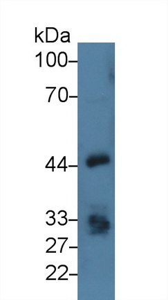 Polyclonal Antibody to Epithelial Cell Adhesion Molecule (EPCAM)