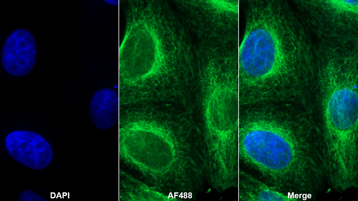 Polyclonal Antibody to Protein Tyrosine Phosphatase Receptor Type S (PTPRS)