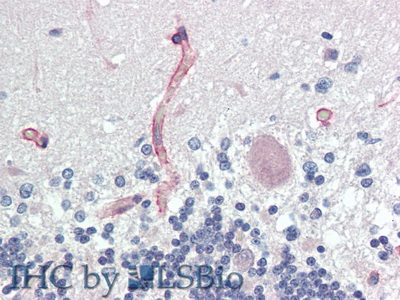 Polyclonal Antibody to Agrin (AGRN)