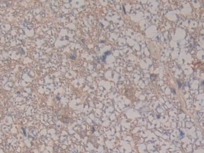 Polyclonal Antibody to Complement Component 8b (C8b)