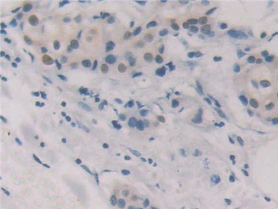 Polyclonal Antibody to Glutathione Reductase (GR)