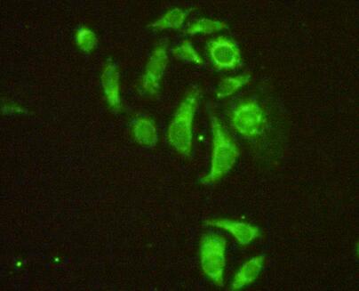 Polyclonal Antibody to Microtubule Associated Protein 4 (MAP4)