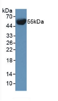 Polyclonal Antibody to Involucrin (INV)