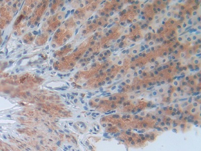 Polyclonal Antibody to Involucrin (INV)