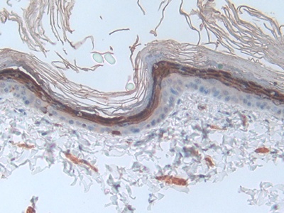 Polyclonal Antibody to Involucrin (INV)