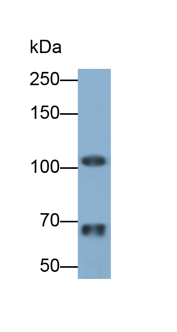 Polyclonal Antibody to Involucrin (INV)