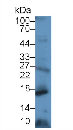 Polyclonal Antibody to Cluster of Differentiation 59 (CD59)