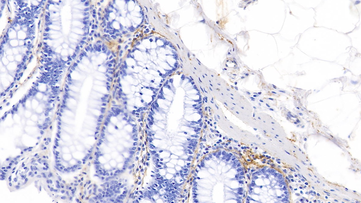 Polyclonal Antibody to Elastin (ELN)