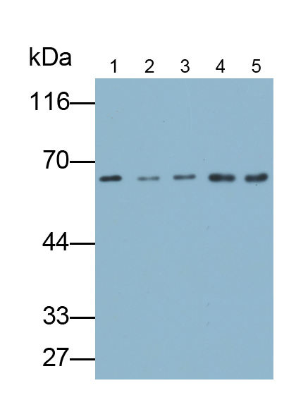 Polyclonal Antibody to Elastin (ELN)