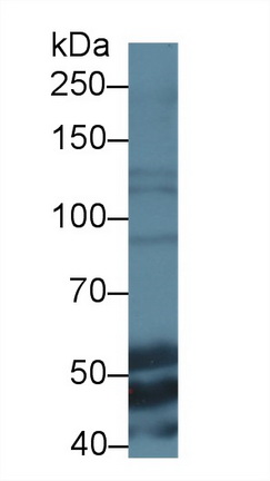 Polyclonal Antibody to Elastin (ELN)