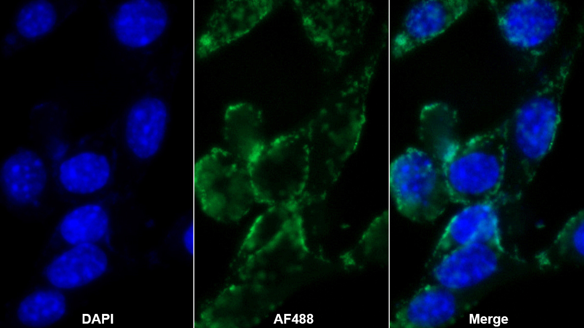 Polyclonal Antibody to Elastin (ELN)