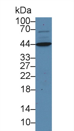 Polyclonal Antibody to Beta Actin (ACTB)