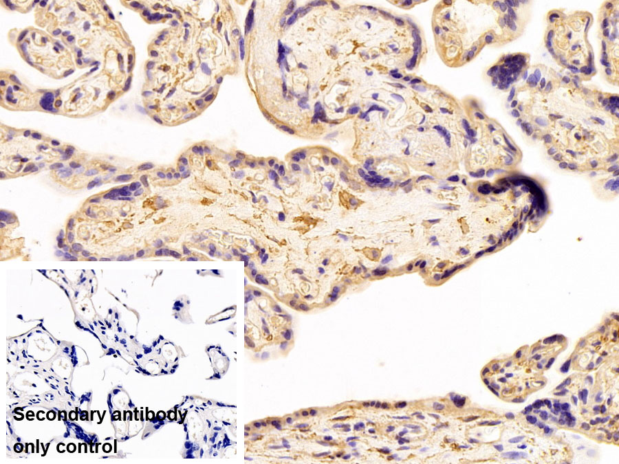 Polyclonal Antibody to Beta Actin (ACTB)