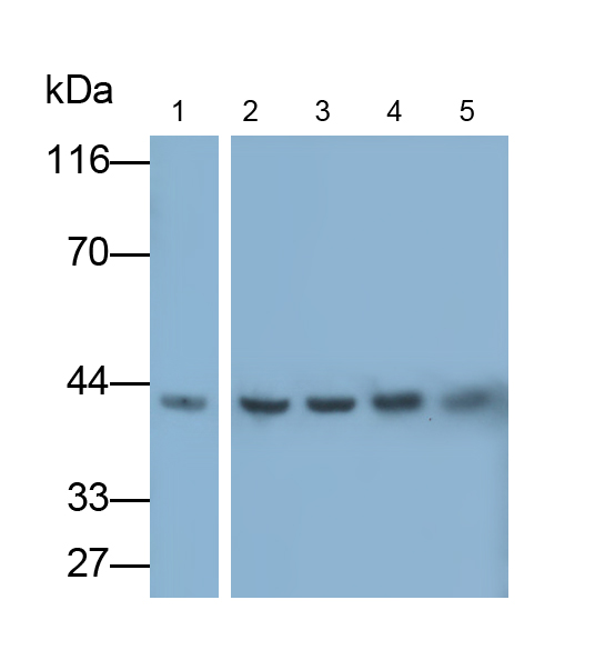 Polyclonal Antibody to Beta Actin (ACTB)