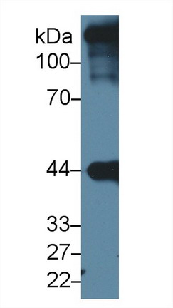 Polyclonal Antibody to Actin Alpha 1, Cardiac Muscle (ACTC1)