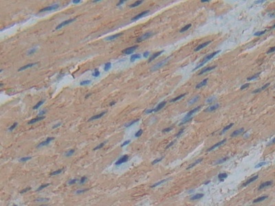 Polyclonal Antibody to Actin Alpha 1, Cardiac Muscle (ACTC1)