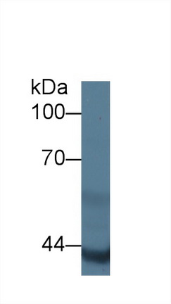 Polyclonal Antibody to Actin Alpha 2, Smooth Muscle (ACTa2)