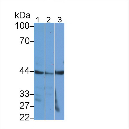 Polyclonal Antibody to Actin Alpha 2, Smooth Muscle (ACTa2)