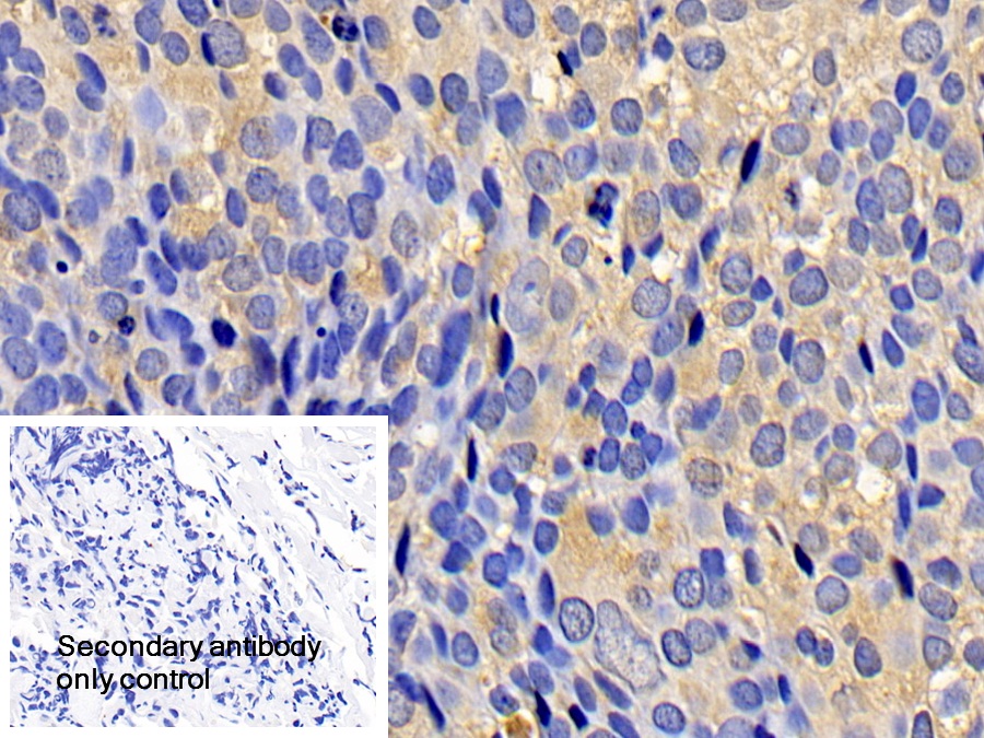 Polyclonal Antibody to Bcl2 Associated X Protein (Bax)