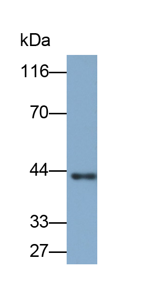 Polyclonal Antibody to Actin Gamma 2, Smooth Muscle (ACTg2)