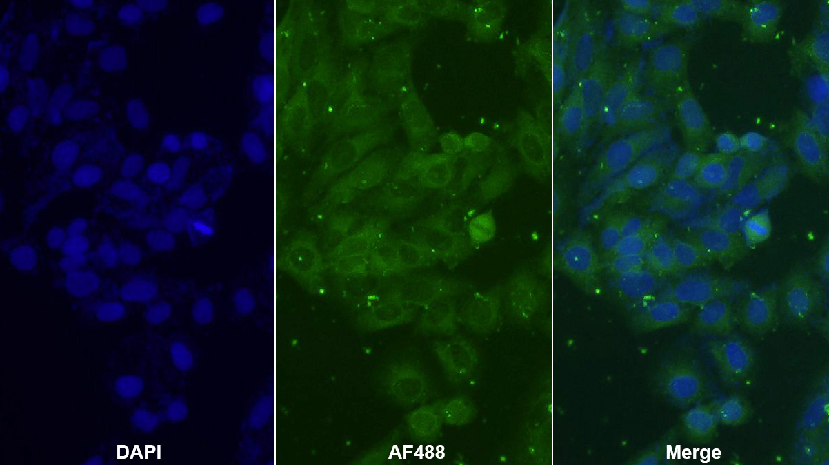 Polyclonal Antibody to Actin Gamma 2, Smooth Muscle (ACTg2)