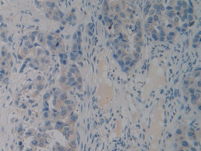 Polyclonal Antibody to Pituitary Adenylate Cyclase Activating Peptide (PACAP)