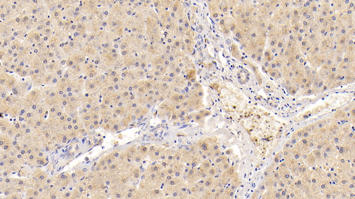 Polyclonal Antibody to Adipose Differentiation Related Protein (ADRP)