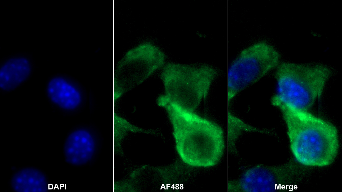 Polyclonal Antibody to Macrophage Expressed Gene 1 Protein (MPG1)