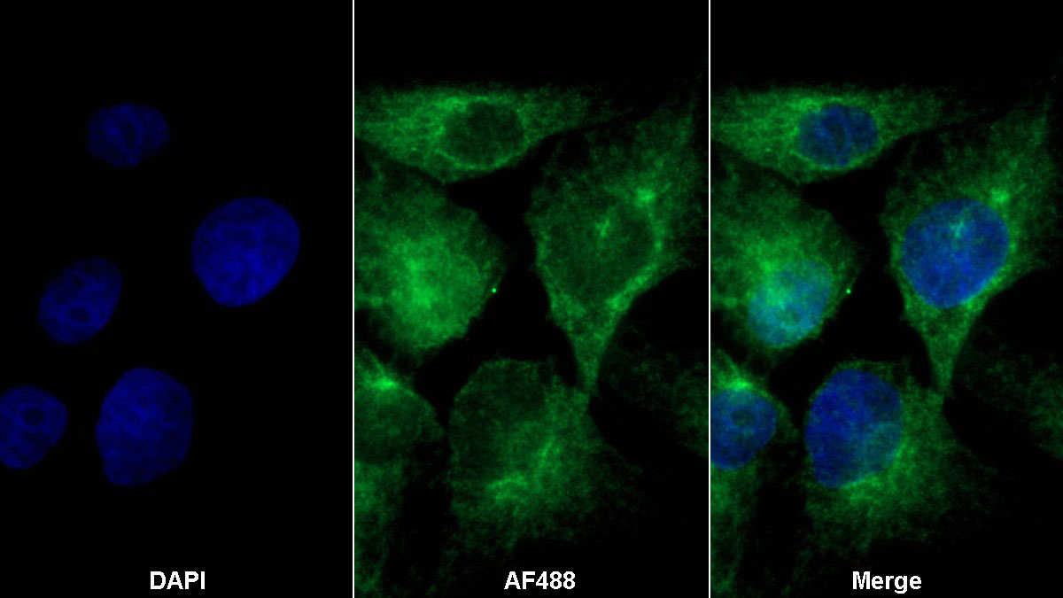 Polyclonal Antibody to Aryl Hydrocarbon Receptor (AhR)