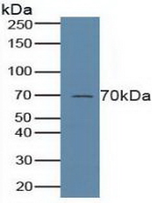 Polyclonal Antibody to 5-Lipoxygenase (5-LO)