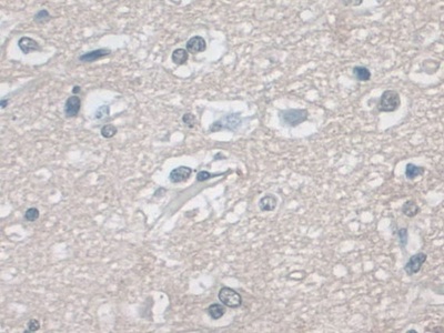 Polyclonal Antibody to Extracellular Signal Regulated Kinase 1 (ERK1)