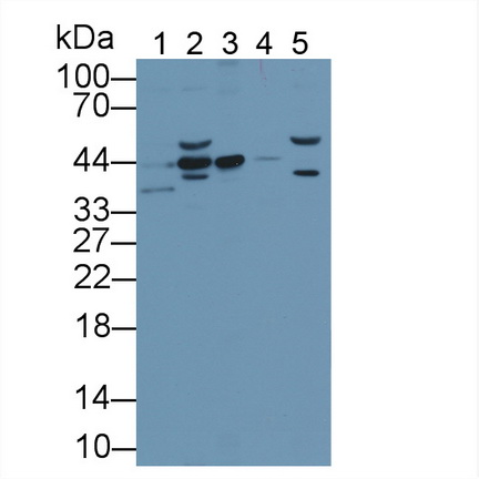 Polyclonal Antibody to Extracellular Signal Regulated Kinase 1 (ERK1)