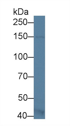 Polyclonal Antibody to Apoptosis Signal Regulating Kinase 1 (ASK1)