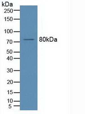 Polyclonal Antibody to Acid Sphingomyelinase (ASM)