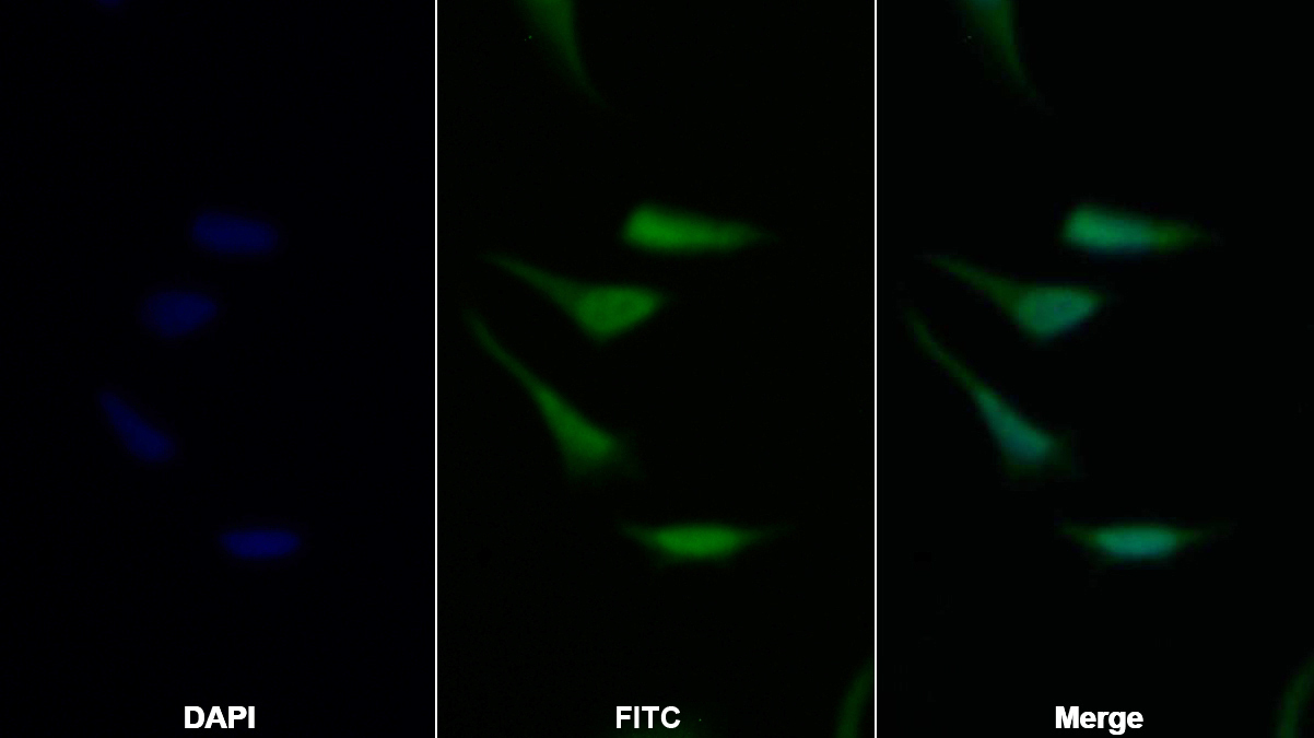 Polyclonal Antibody to Ataxia Telangiectasia Mutated (ATM)