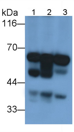 Polyclonal Antibody to Glucokinase Regulatory Protein (GKRP)