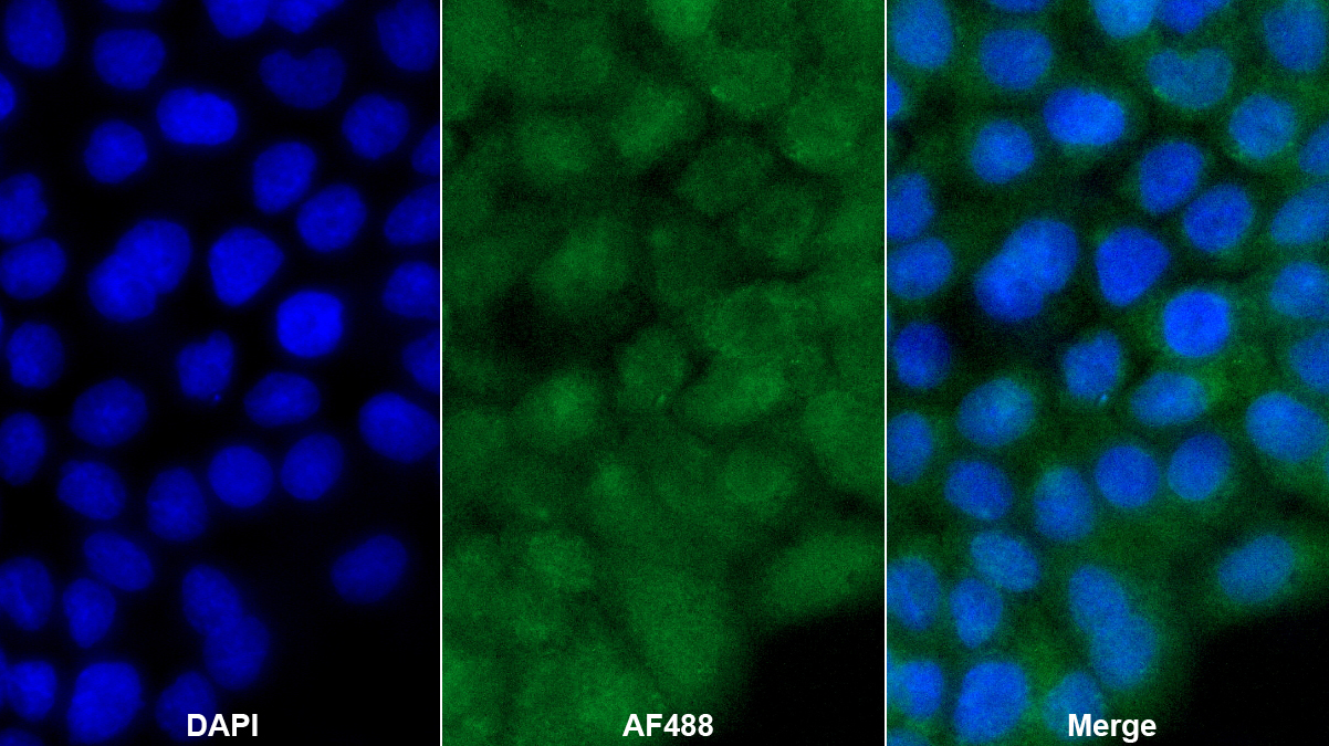 Polyclonal Antibody to Glucokinase Regulatory Protein (GKRP)