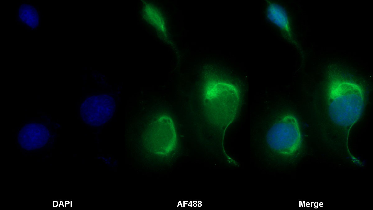 Polyclonal Antibody to Cadherin 5 (CDH5)