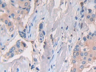 Polyclonal Antibody to Cluster Of Differentiation 74 (CD74)